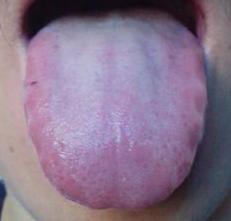 妇科调经第一方逍遥散,月经不调加味逍遥丸