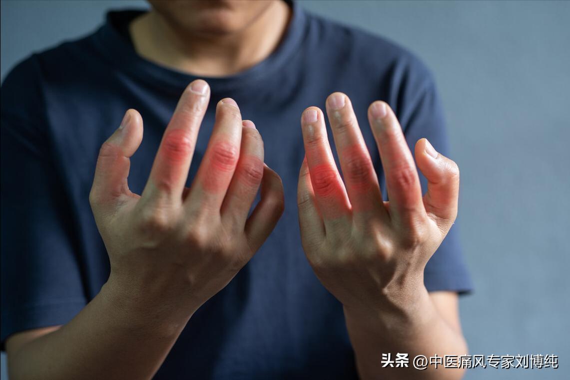 降尿酸的中药对肾有伤害吗,降尿酸保护肾功能的中药