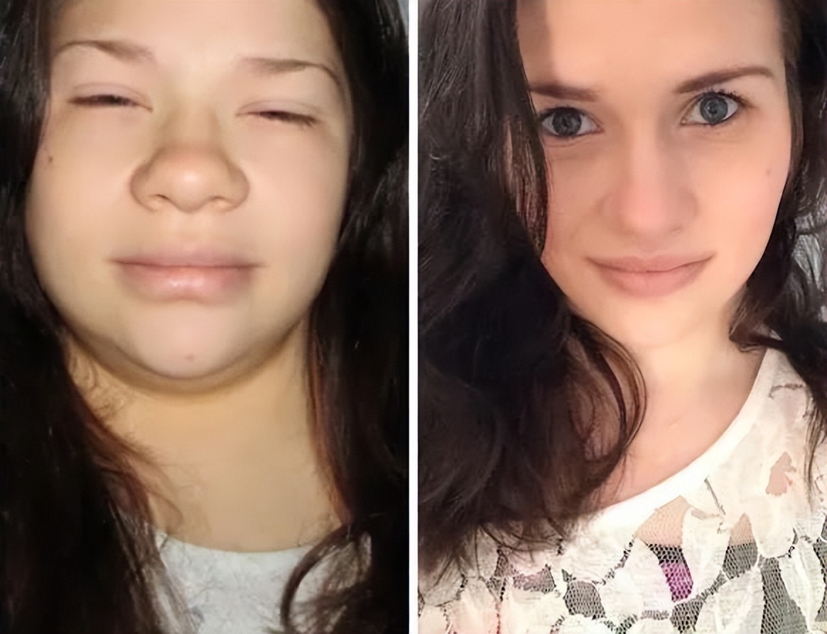 hpv58阳性吃什么食物提高免疫力,易感冒人群吃10种食物增强免疫力