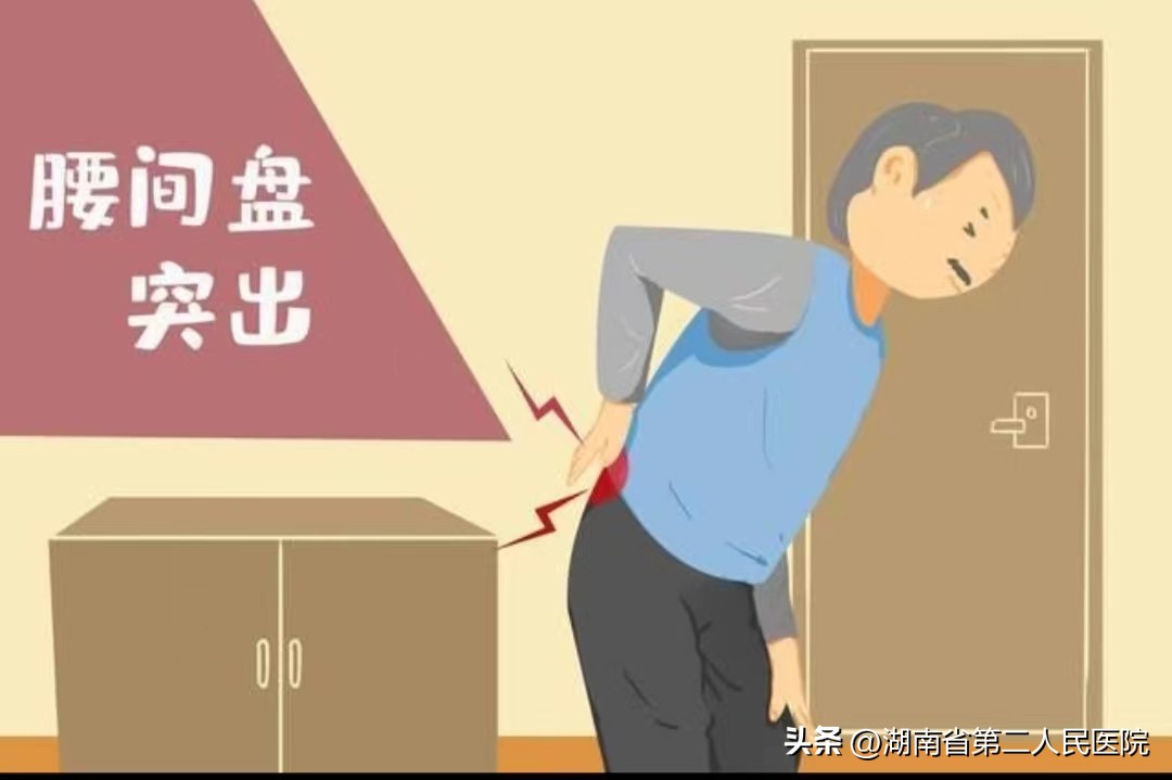 一个小技巧避免腰椎间盘突出,对于腰间盘突出最权威的解读