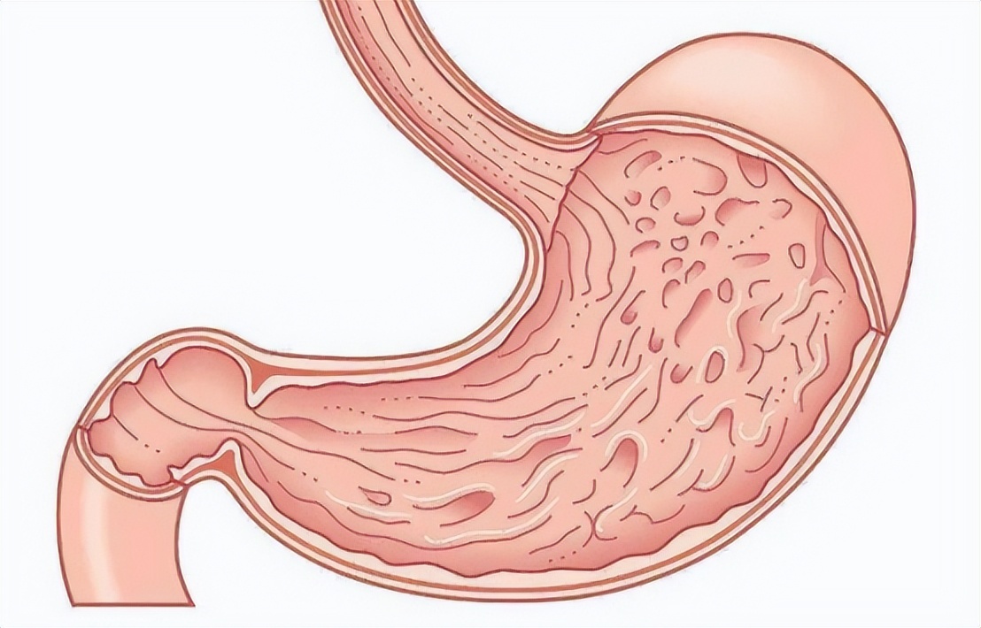 慢性胃炎中医治疗还是西医治疗,慢性胃炎的中医药诊疗方法有哪些