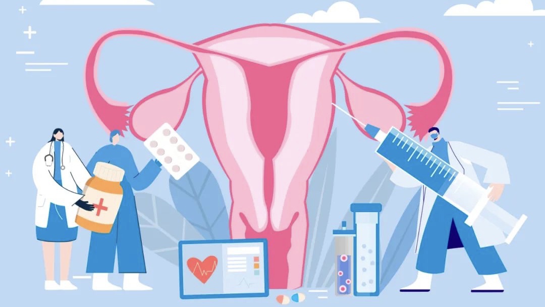 【健康】“大姨妈”又爱又恨，异常子宫出血到底是怎么回事？