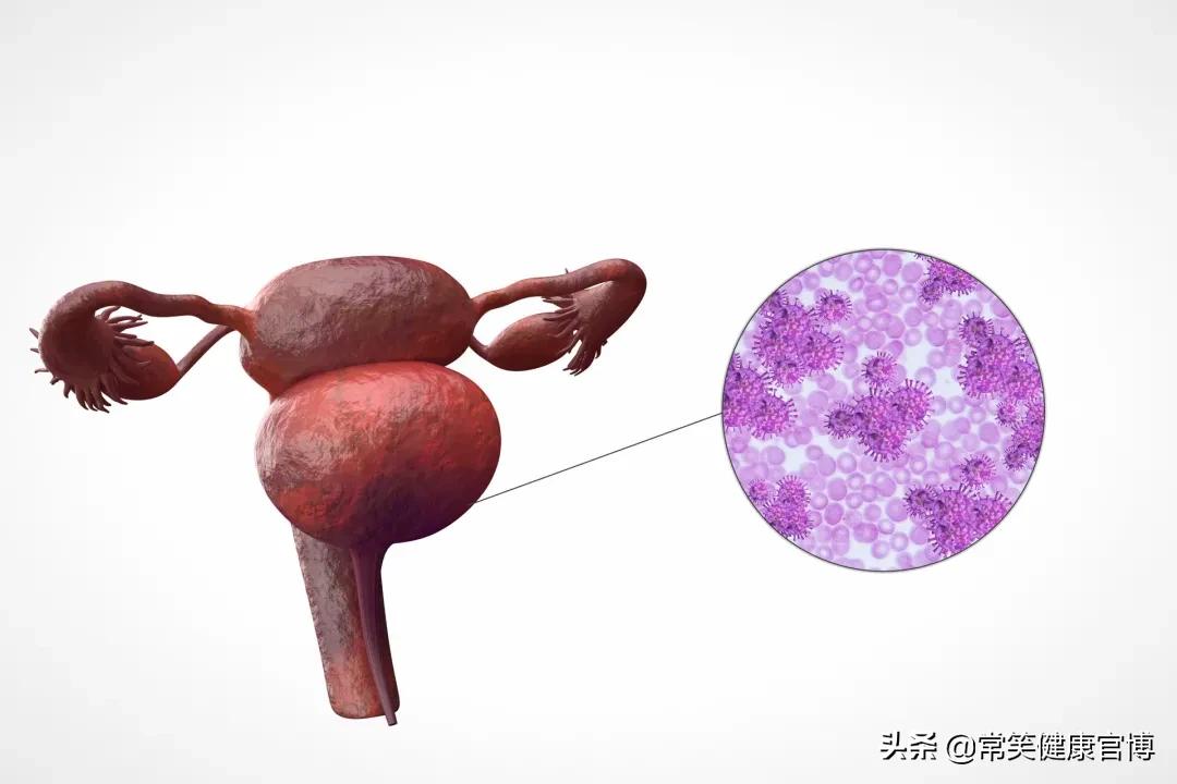 从怀孕就认识的宝妈,孕期白带检查清洁度怎么看