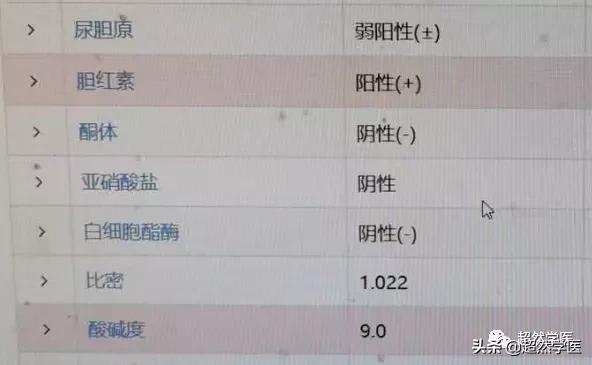 尿检里面有尿胆原但是胆红素正常,尿常规里的尿胆红素是什么