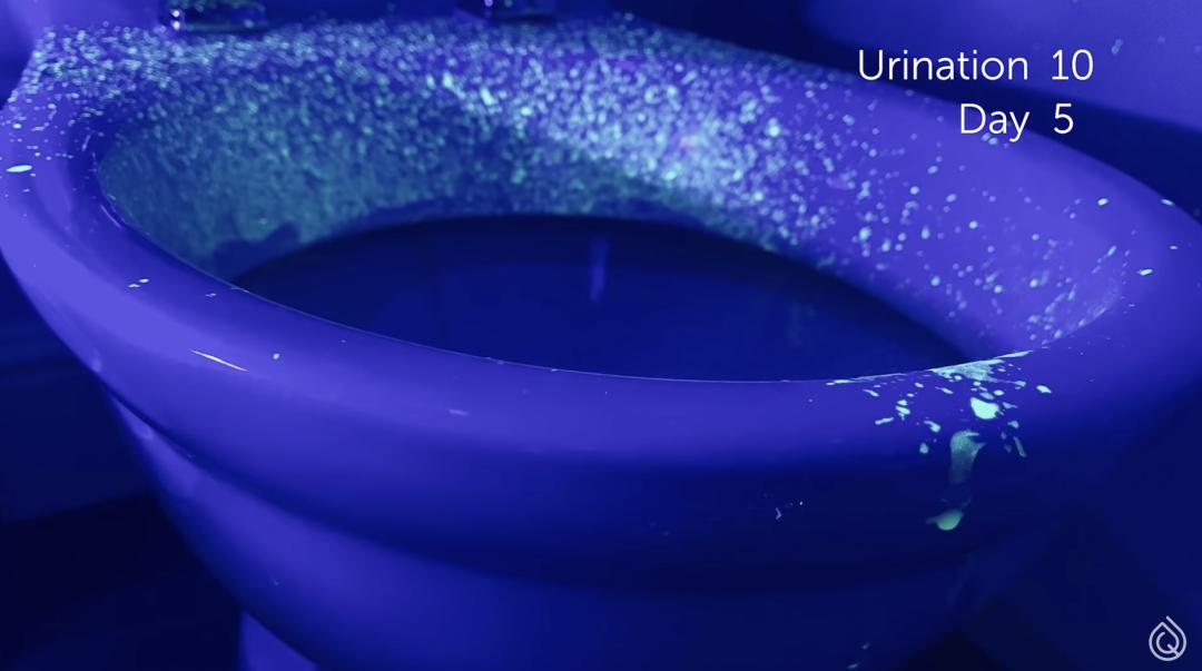 被公厕水溅到会得淋病吗,被公厕水溅到会感染吗