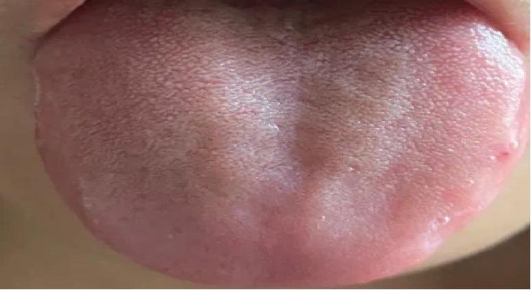 人体脾虚怎么调养,脾胃湿热和脾虚吃什么中成药