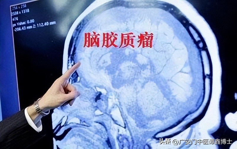 脑胶质瘤发病后过几天症状又好转,脑胶质瘤发生转移怎么办