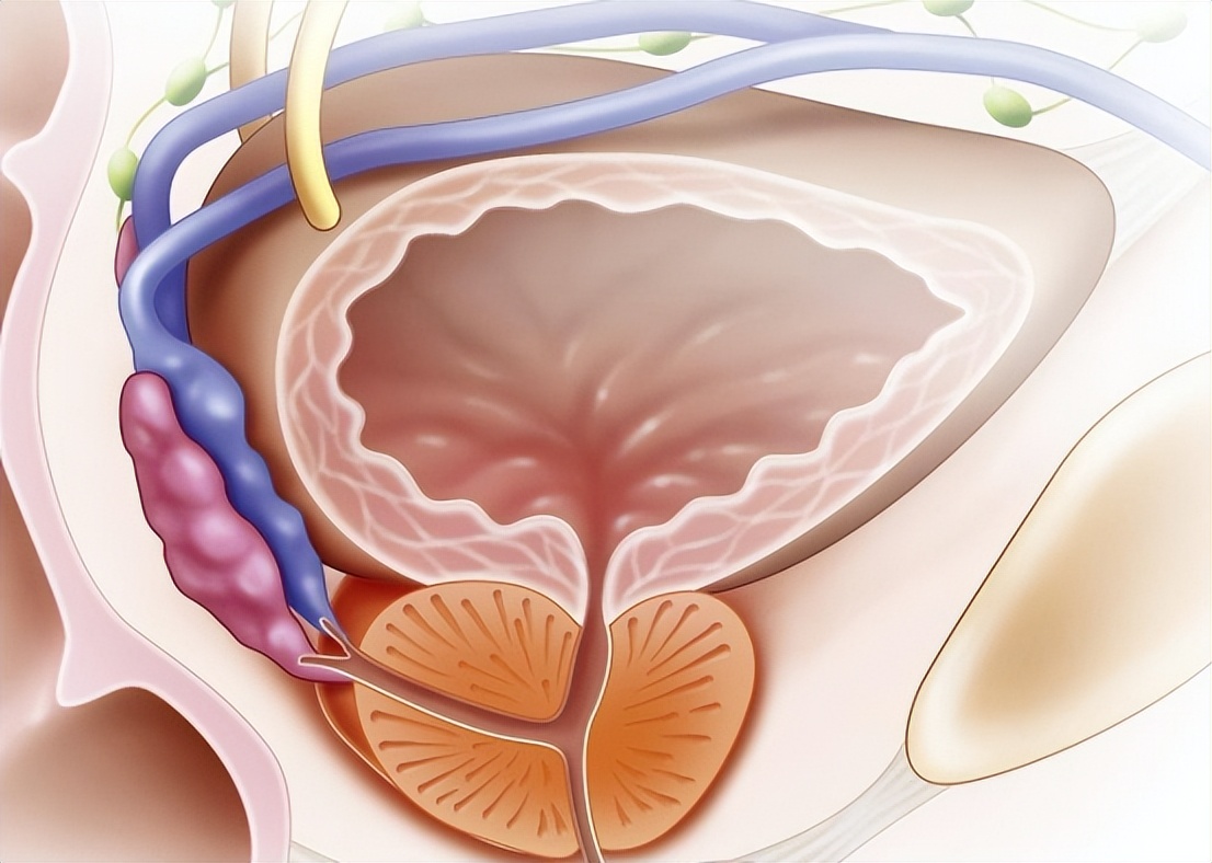尿路感染自救方法,尿路感染怎样长期抑菌治疗