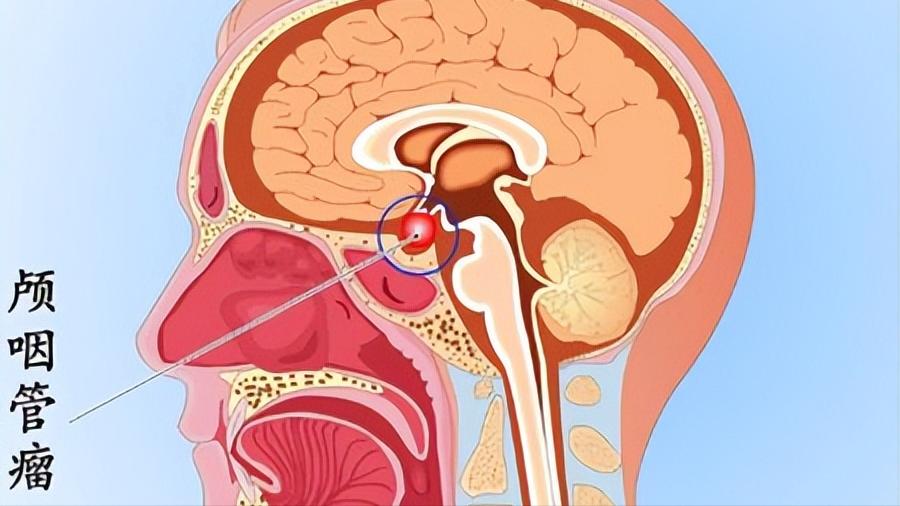 不知道月经准确时间怎么算排卵期,月经过后第几天排卵期