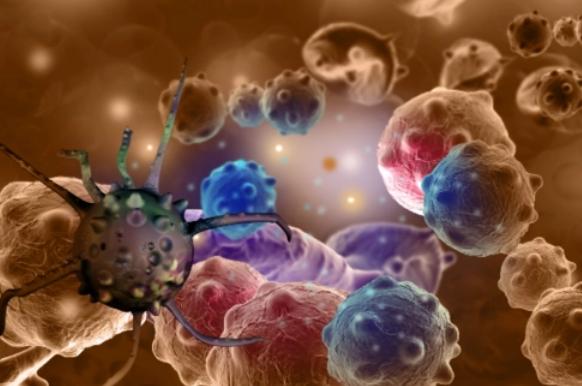 癌症根本不需要治，治好的都是误诊了？医生告诉你4个真相