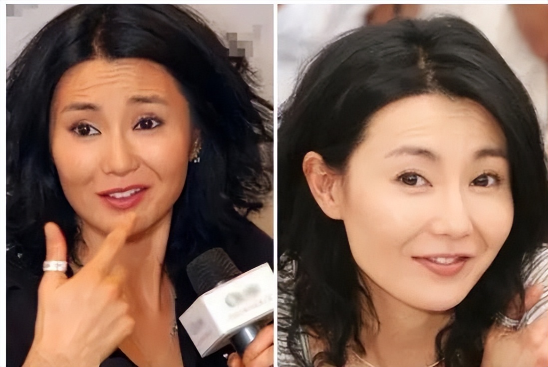 千万别做拉皮手术后遗症太可怕了,拉皮手术会有什么后遗症吗