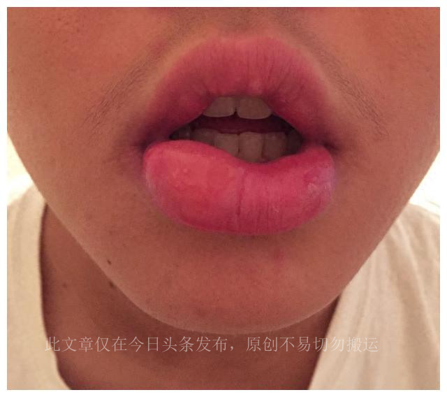 4岁孩子最近总咬指甲咬东西,孩子喜欢咬指甲咬东西