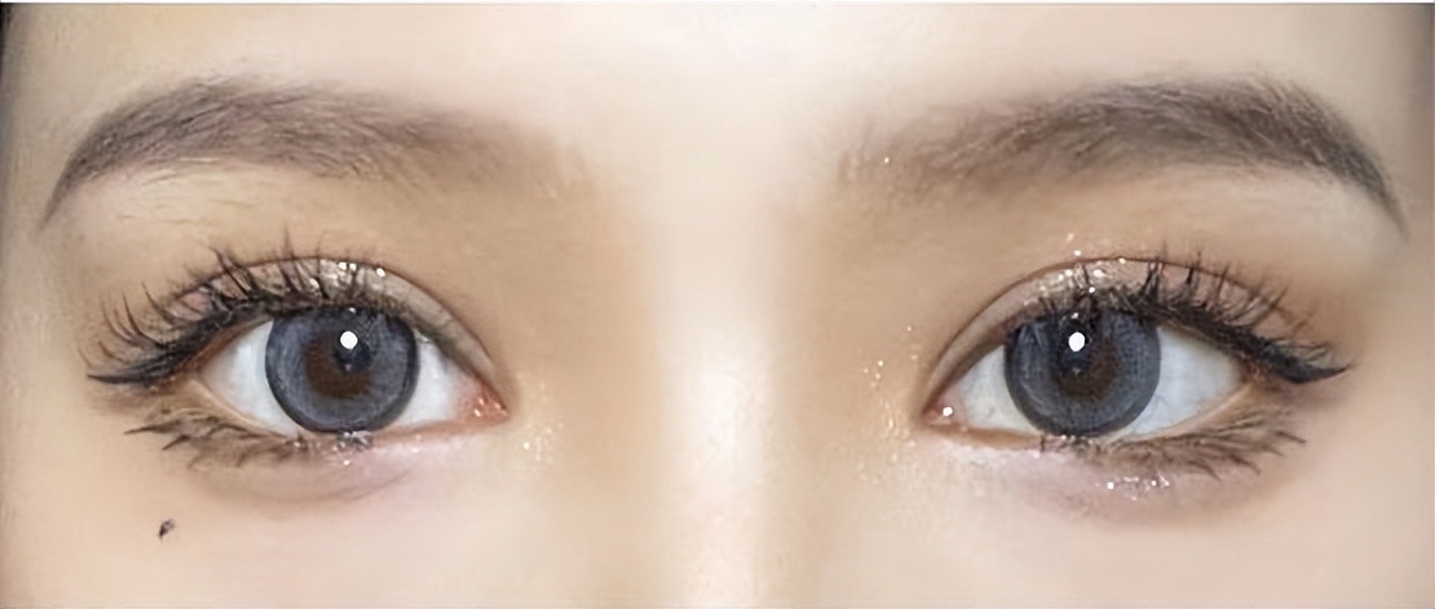 做双眼皮需要了解什么,双眼皮各种类型的知识