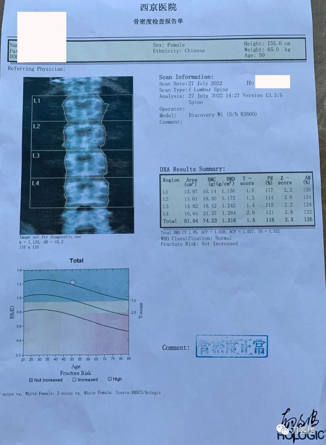 50岁坐一下站起腿发麻,30岁女性左腿麻木是什么病的前兆