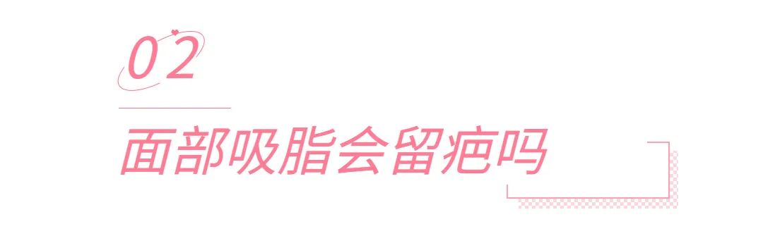 九院韦敏面部吸脂,九院韦敏植骨手术案例