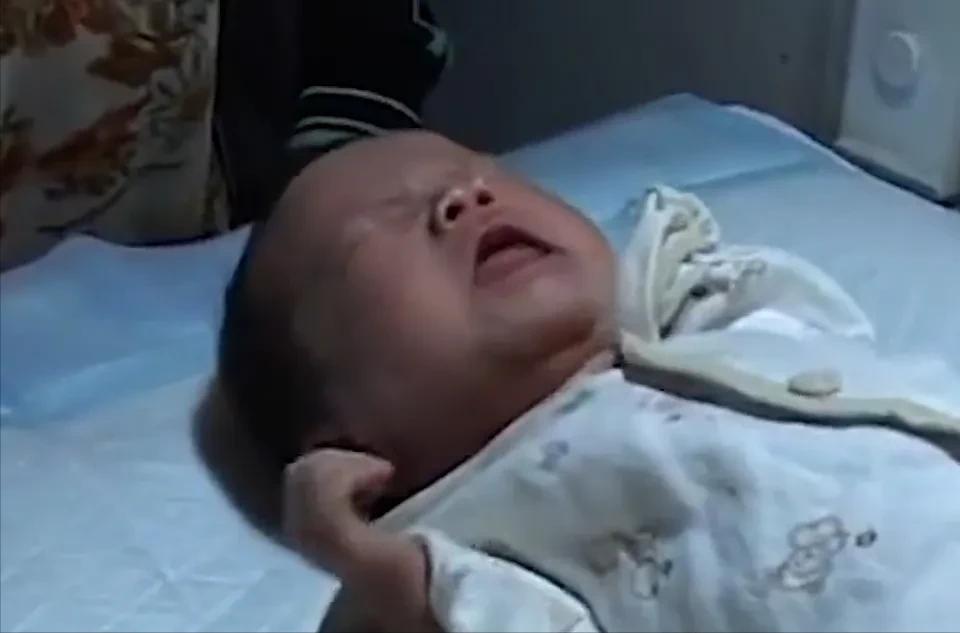 女子生下连体双胞胎后续,女子产下同母异父双胞胎完整版