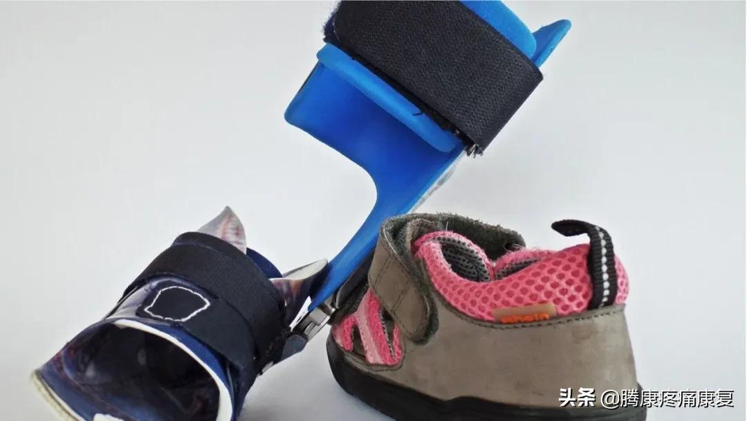 功能性高足弓的练习方式,用什么方法舒缓足弓疼痛