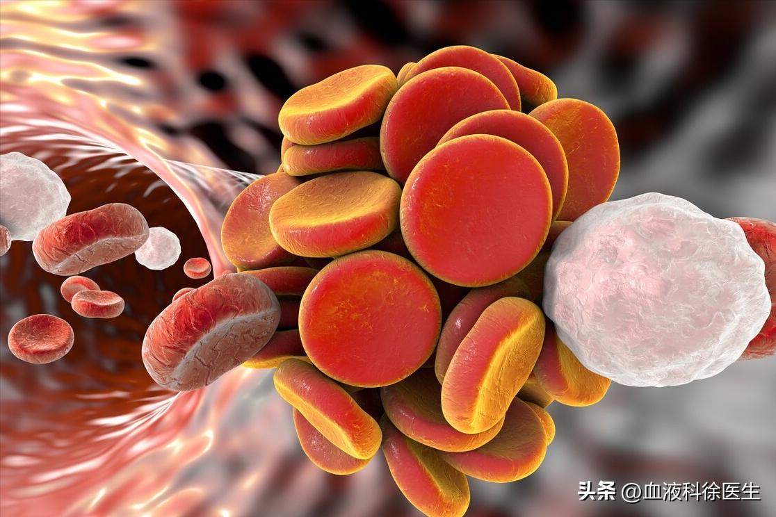 血栓手脚有什么症状和预兆,血栓来临手脚有啥感觉