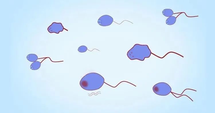 死精中医能调节好吗,死精真的治疗不了吗