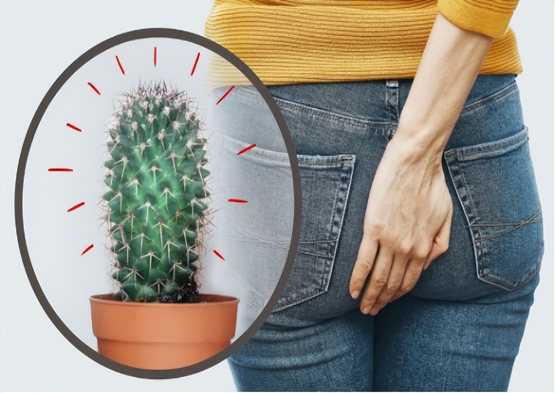 30岁女性频繁肛裂,19岁女生肛裂能自愈吗