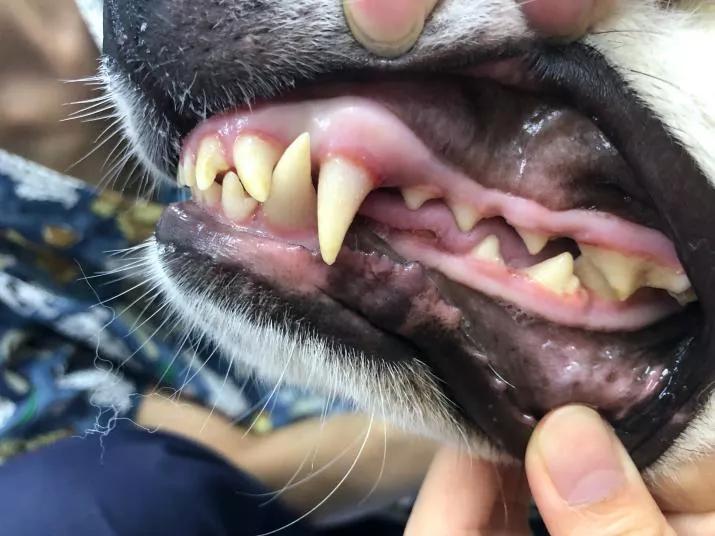 征兵体检牙釉质发育不全,牙釉质发育不全该怎么办