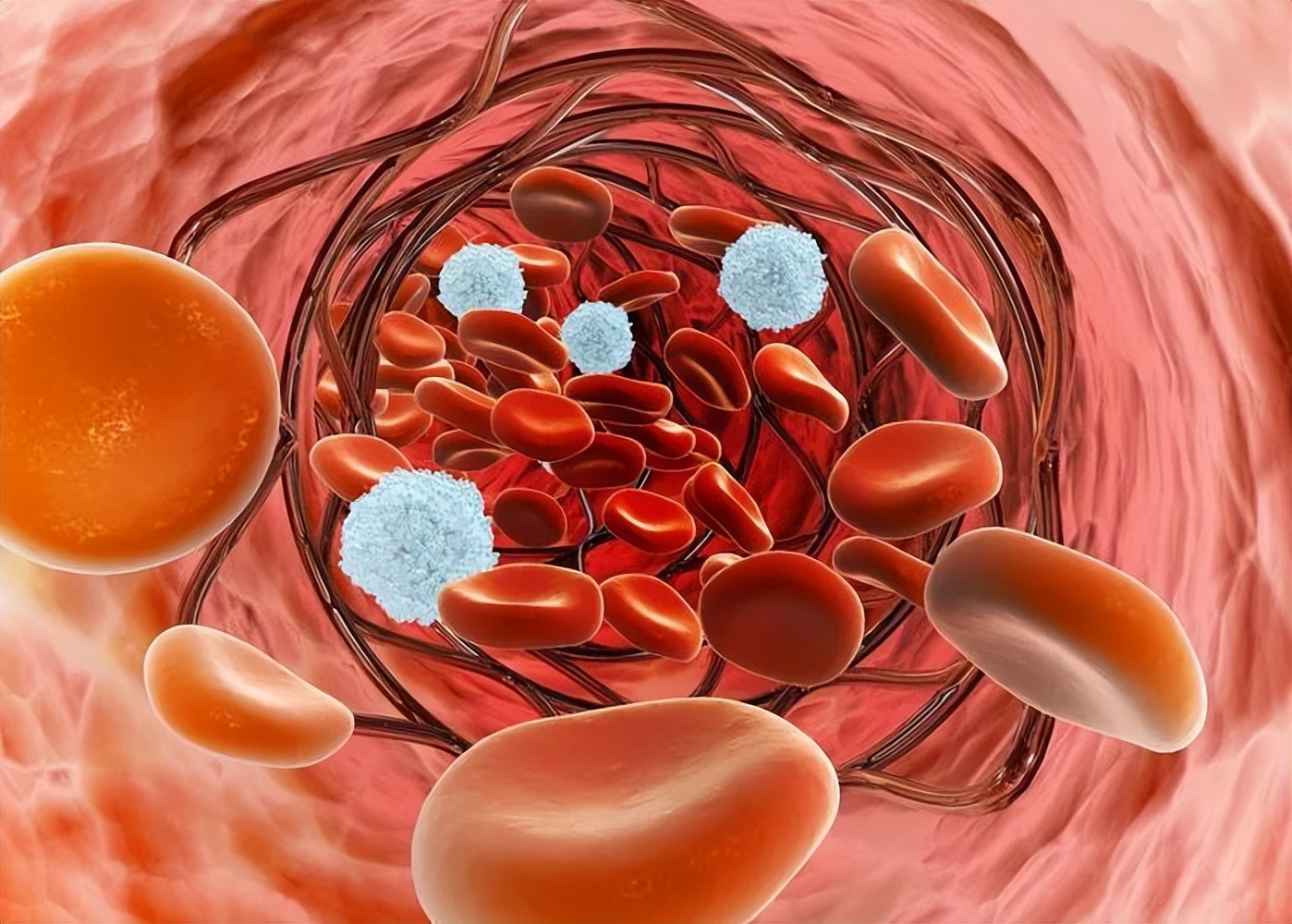 胆固醇血脂高有哪些食物不能吃,什么食物降血脂和胆固醇还护肝