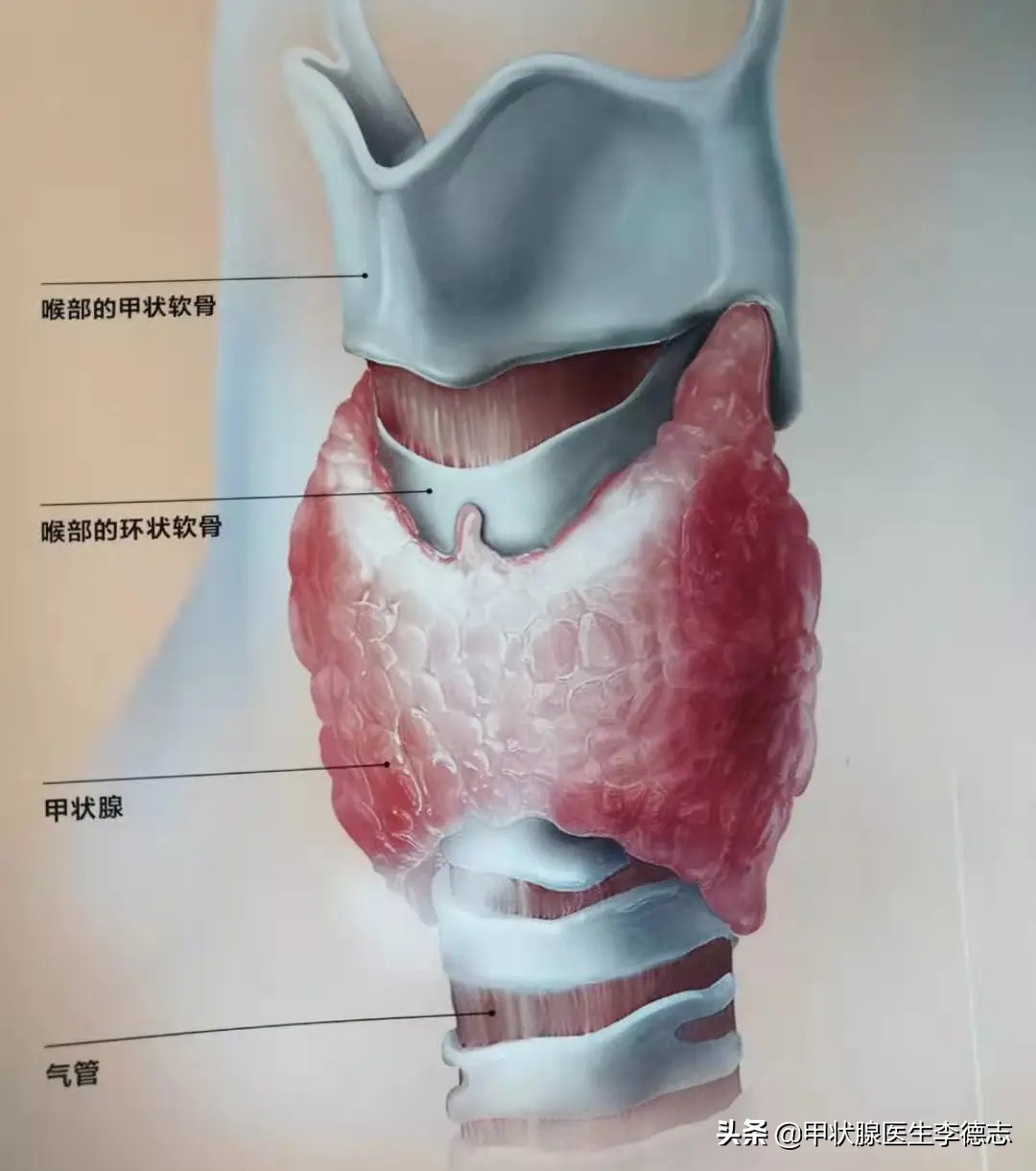 甲状腺癌实例,甲状腺乳头状癌半切和全切