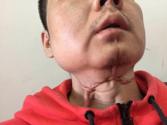 恶魔果实槟榔,恶魔果实为什么只能吃一个