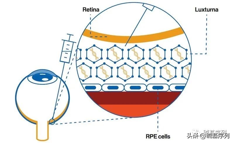 基因治疗眼睛最新消息,基因治疗最新突破消息