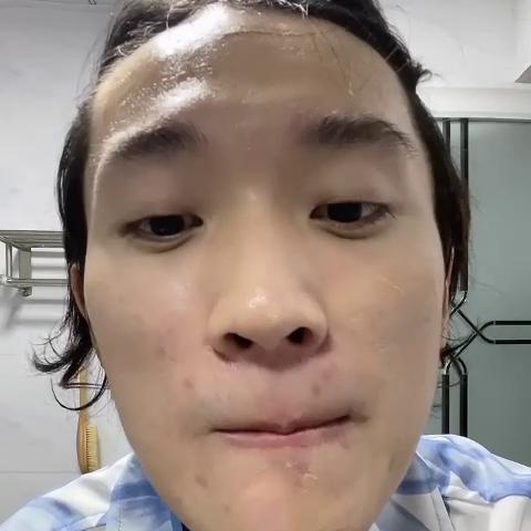 油皮黑头闭口清理方法,油皮去黑头闭口粉刺