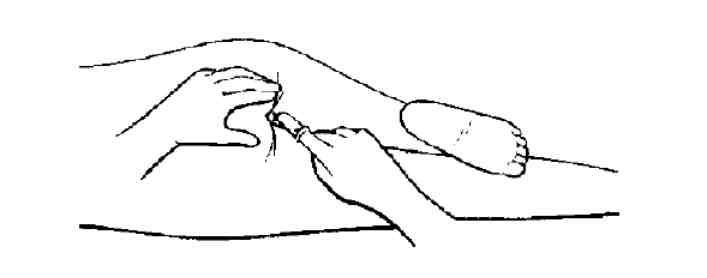 NO.7干货满满：关于宝宝使用退热栓的那些事