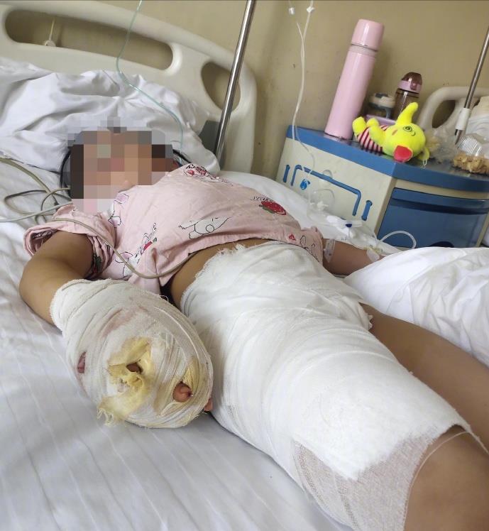 后妈虐待女童最新案件,后妈虐待13岁孩子新闻