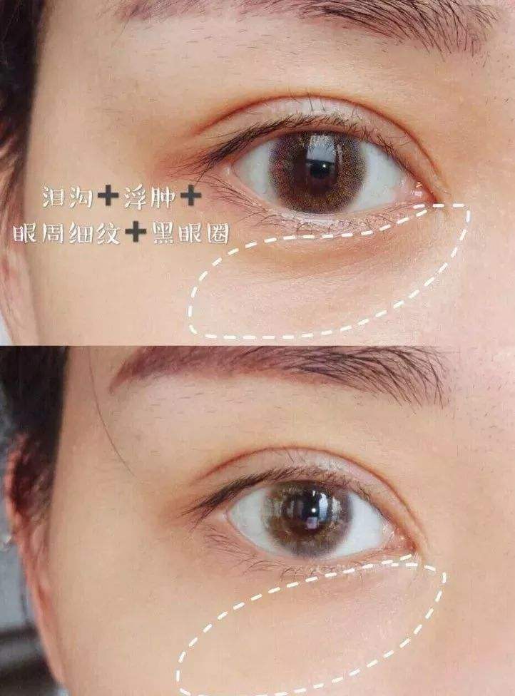 修复眼部细纹的眼霜推荐,去眼部细纹的眼霜推荐