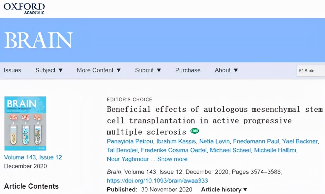 干细胞风湿性关节炎,风湿免疫系统疾病通过干细胞治疗
