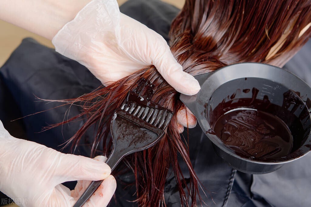 染发头皮屑多是什么原因,染发之后头皮屑严重是什么原因