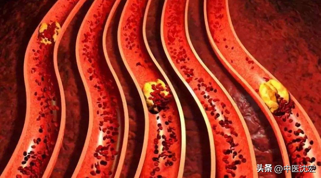 瘀血在哪,瘀血怎么用药