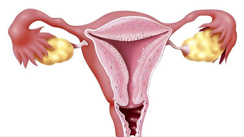 宫颈糜烂持续一年多了该怎么治疗,重度宫颈糜烂是怎么回事该怎么办