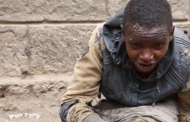 故事:非洲22岁小伙吃沙子上瘾,一天要吃五斤,身体发生怎样改变