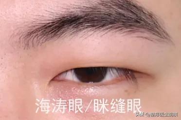 男人常见的眼型测试,常见眼型自测