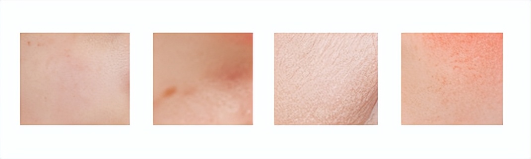 悦妍专注问题性皮肤修复,专研敏感肌美妆品牌