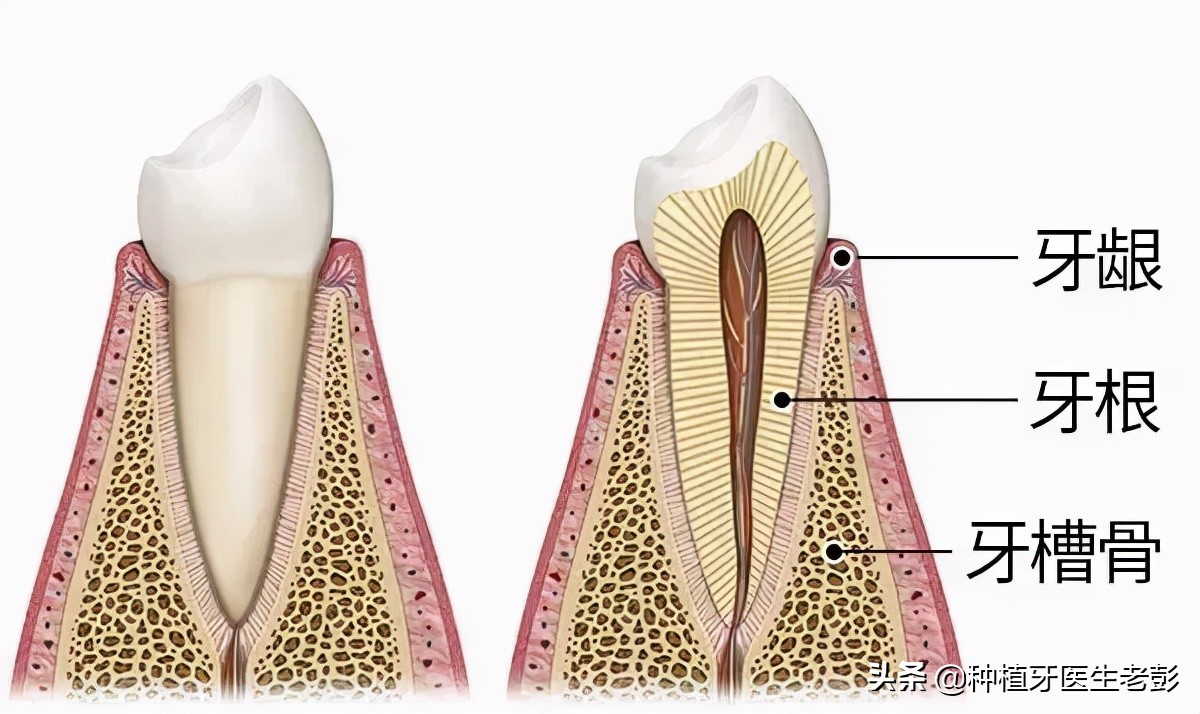 咨询医生治疗牙周炎,我想种植牙