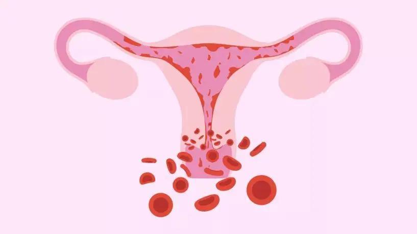 子宫内膜增厚是癌症的征兆吗,子宫内膜增厚是子宫癌症的前兆吗