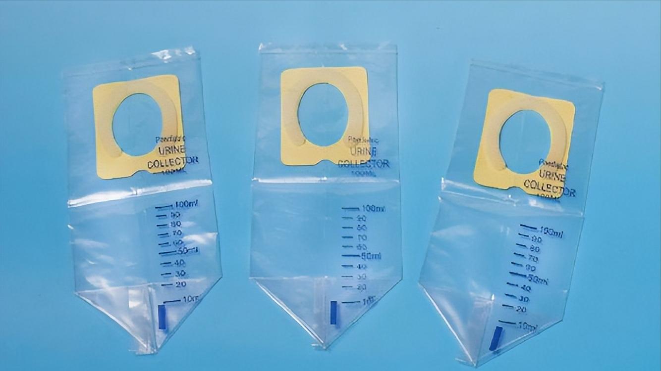 尿路感染多严重才可以感染到肾,切掉一个肾对泌尿系有影响么