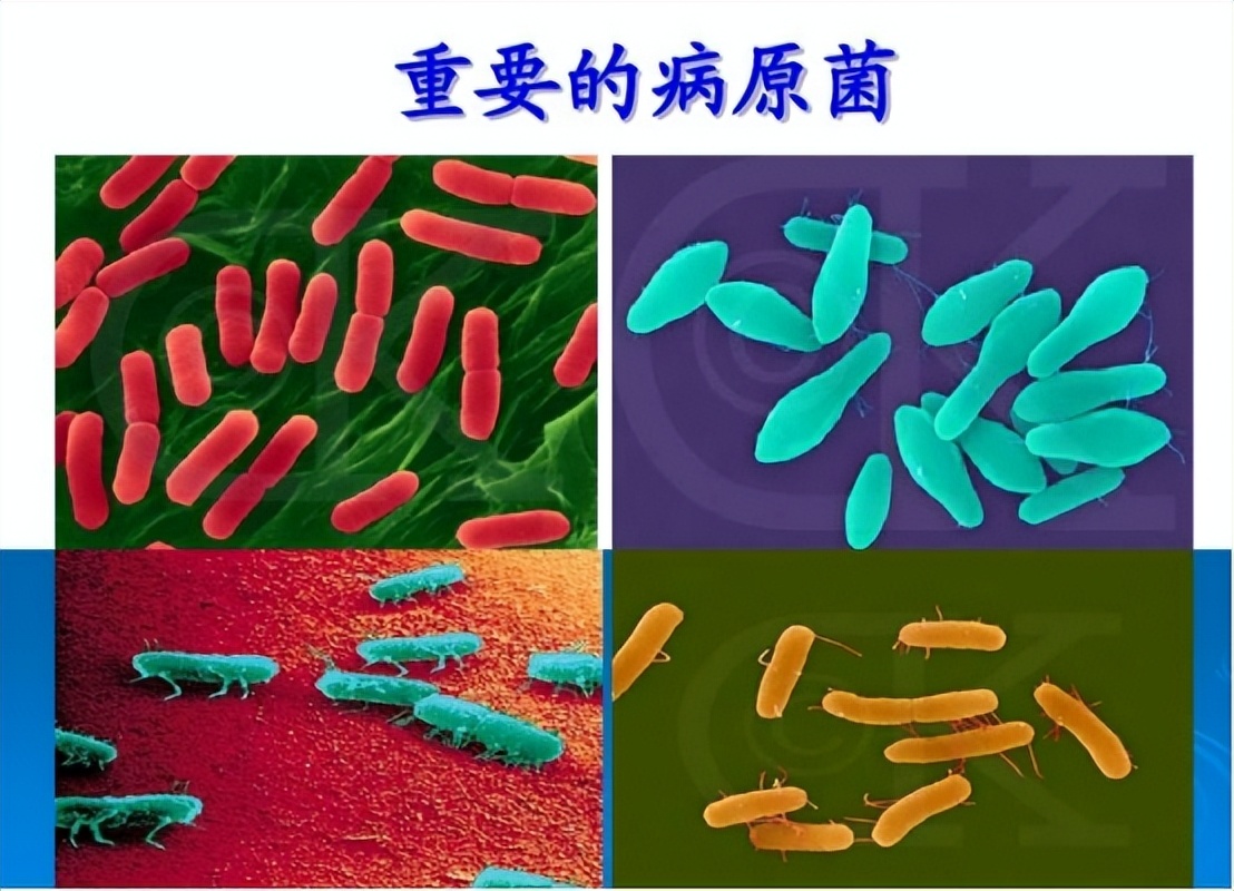 医院内尿路感染常见的诱因,尿路感染最严重的后果