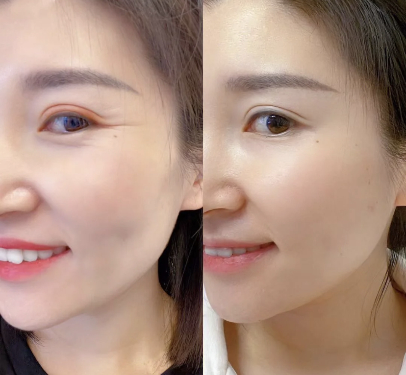 让你反复回购的宝藏护肤品,40岁好用不贵的护肤品国货