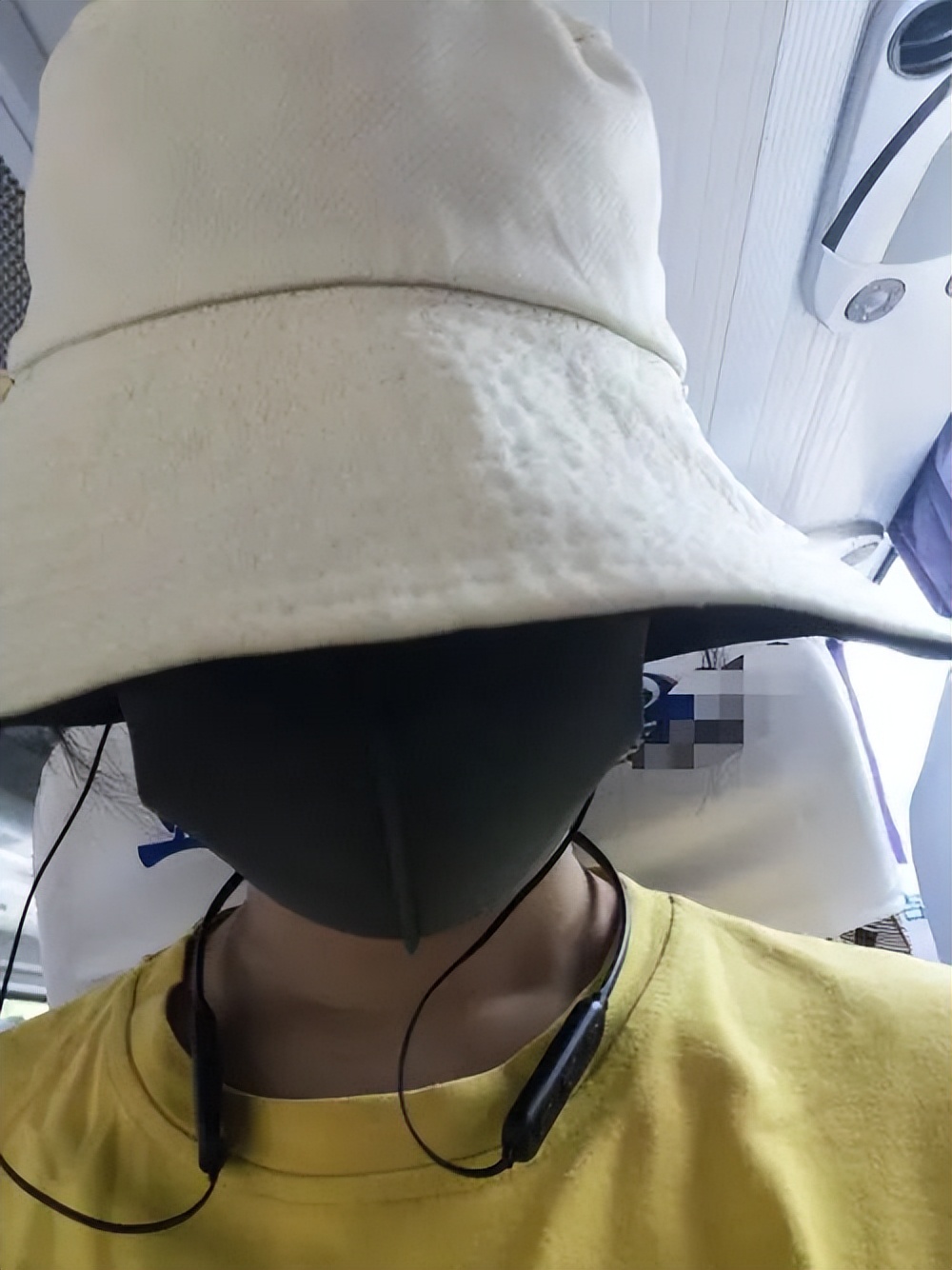 维a酸乳膏可以改善毛孔粗大吗,油皮毛孔粗大黑头多要怎么改善