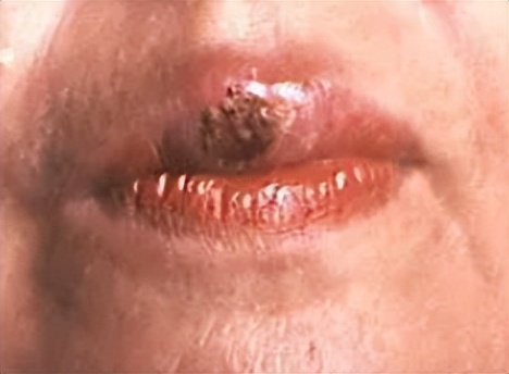 嫖娼后，怎么知道自己有没有染病？