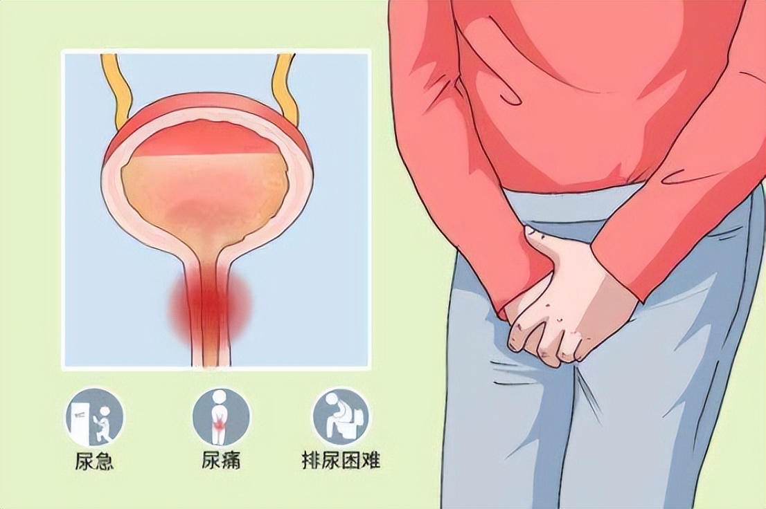 性接触传播疾病的防范教育,通过性传播的疾病有什么危害