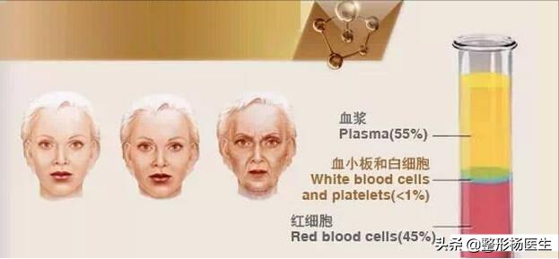 水光针能去除眼部细纹吗,菲洛嘉水光针可以去除细纹吗