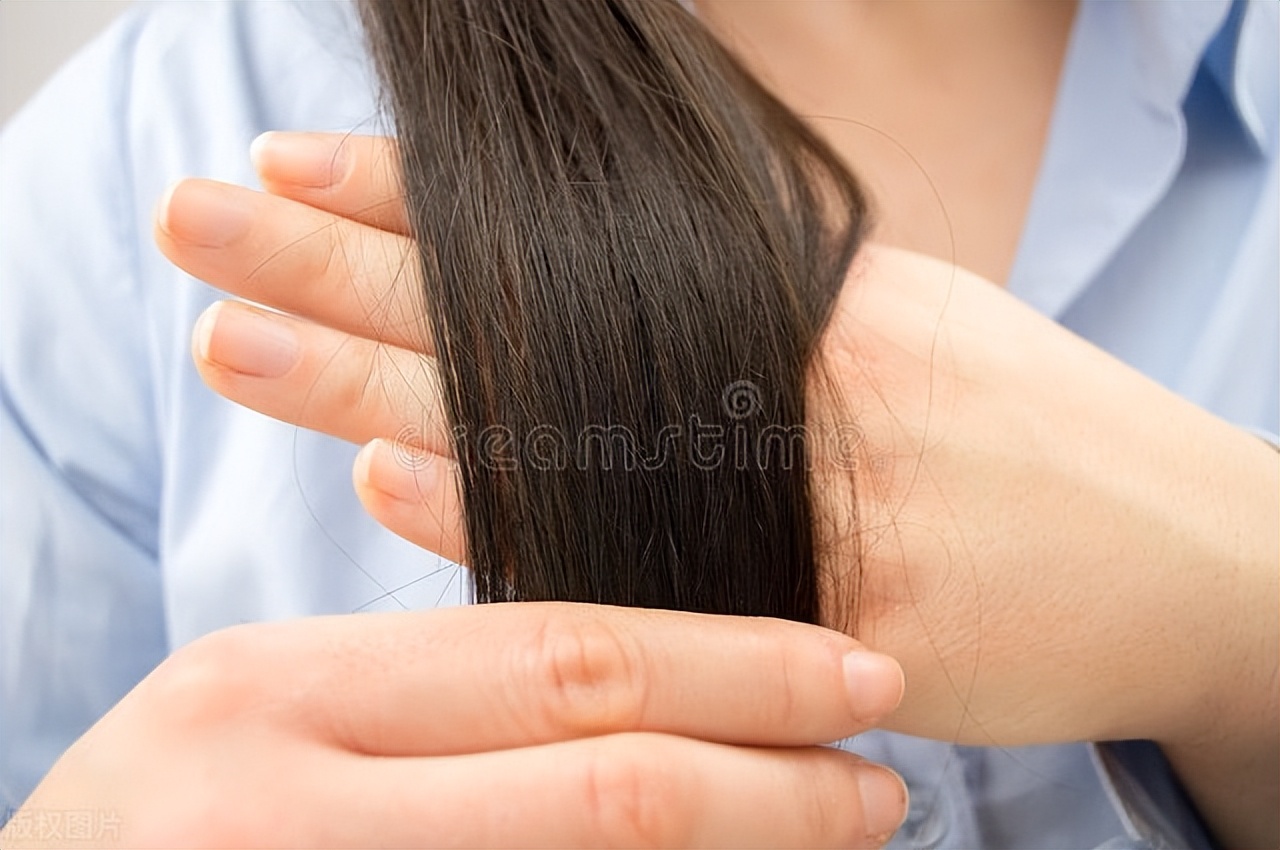 染发头皮屑多是什么原因,染发之后头皮屑严重是什么原因